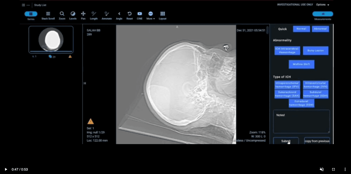 Dicom Viewer